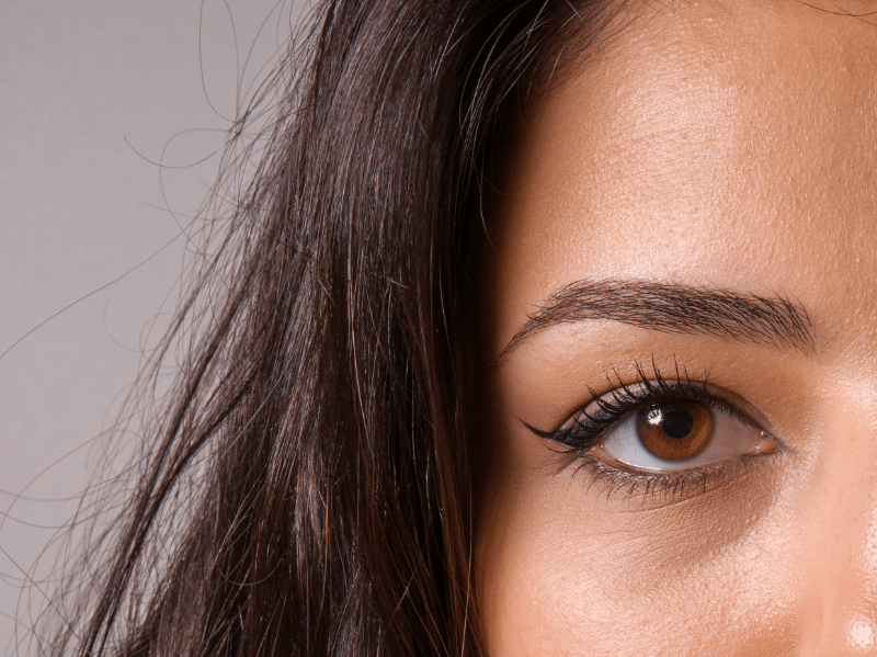 5 Questions When Looking At Brow Lift Before And After Photos