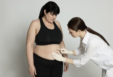 liposuction frequently asked questions